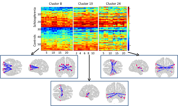 Brain connectivity in schizophrenia